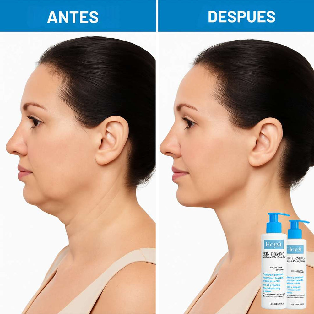 Crema Reafirmante Hoygi™ ✨ | Piel más Firme y Rejuvenecida ✔