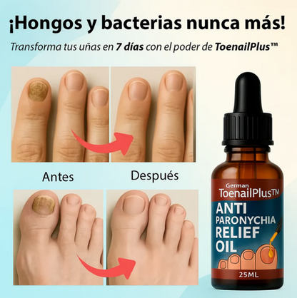 ANTIHONGOS PROMOCIÓN PAGUE 1 LLEVE 2