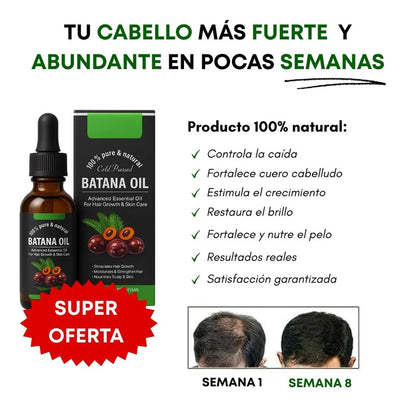 ACEITE DE BATANA PREMIUM X 2 UNIDADES🔥| RECUPERA TU CABELLO ✔