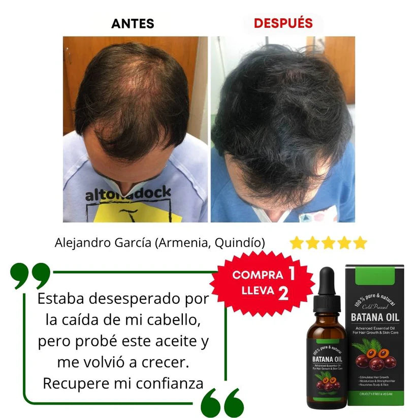 ACEITE DE BATANA PREMIUM X 2 UNIDADES🔥| RECUPERA TU CABELLO ✔