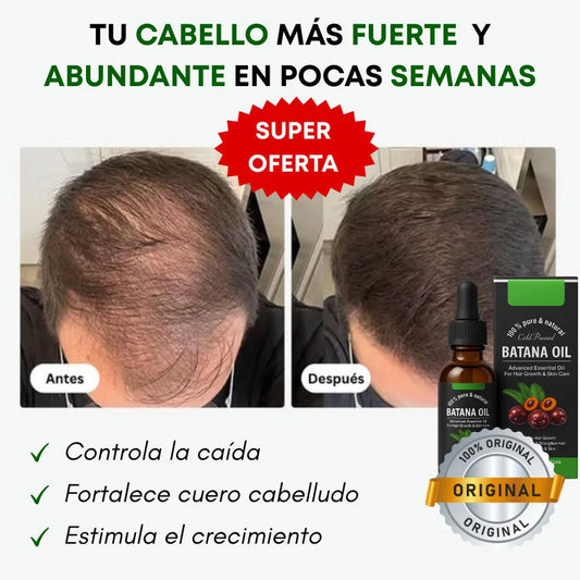 ACEITE DE BATANA PREMIUM X 2 UNIDADES🔥| RECUPERA TU CABELLO ✔