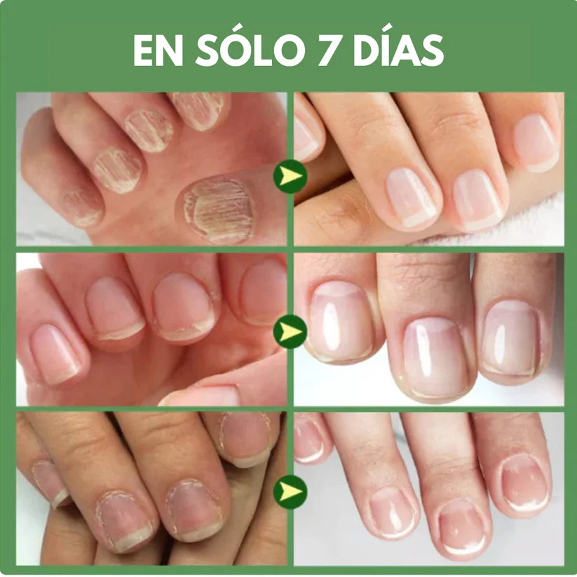 ⚡ULTRANAILS ✨ | FORTALECE Y ACELERA EL CRECIMIENTO DE TUS UÑAS 💅✨